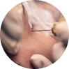 Cortisone